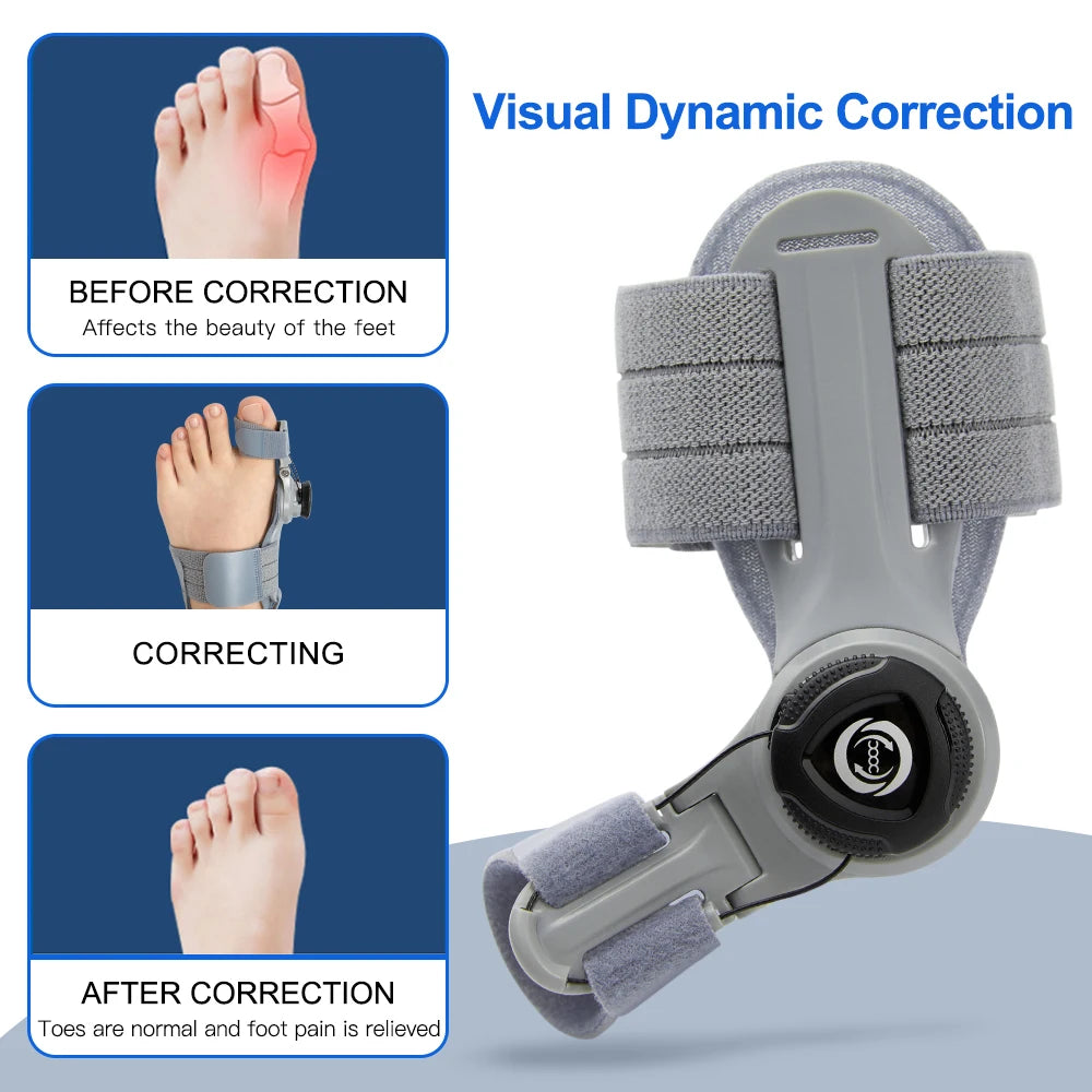 Bunion Corrector Unisex Foot Hallux Valgus Braces Rotatable Toe Separator Straightener Adjustable Pedicure Finger Toe Corrector - NJPH Best Selling 